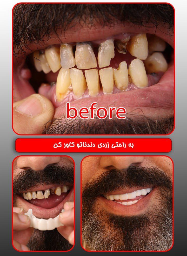 ترو اسمایل اصلی آلمانی رزین به همراه جایزه 200 هزار تومانی